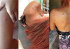 Adolescente de 14 anos é arrastada e atropelada após mulher desconfiar de suposto caso de marido