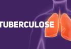 No Dia Mundial de Luta contra a Tuberculose, SMS faz alerta sobre doença que ainda circula em Três Lagoas