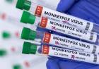 Três Lagoas notifica mais dois casos suspeitos da Varíola Monkeypox. SMS investiga 05 casos no total