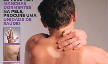 JANEIRO ROXO – Saúde de Três Lagoas orienta população sobre importância do diagnóstico e prevenção da Hanseníase