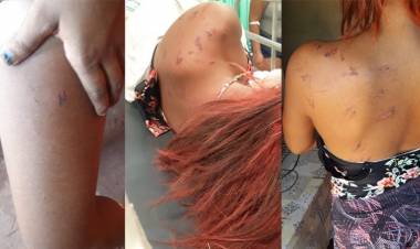 Adolescente de 14 anos é arrastada e atropelada após mulher desconfiar de suposto caso de marido