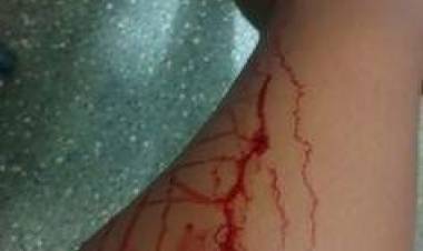 Adolescente é esfaqueada durante briga em escola