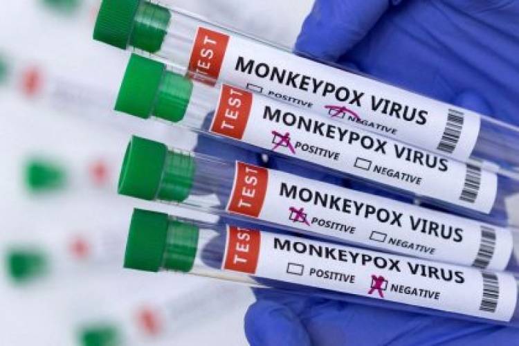 Três Lagoas notifica mais dois casos suspeitos da Varíola Monkeypox. SMS investiga 05 casos no total